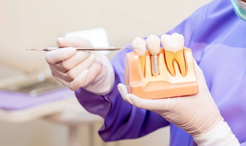 Dental Implants for Individuals with Diabetes : Special Care